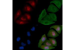 ABIN6258502 and ABIN6274615 staining Hela cells by IF/ICC. (CDCA2 抗体  (Internal Region))