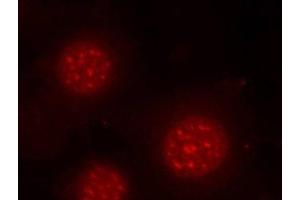 Immunofluorescence analysis of methanol-fixed MCF-7 cells using Phospho-FOXO4(S197) Polyclonal Antibody (FOXO4 抗体  (pSer197))