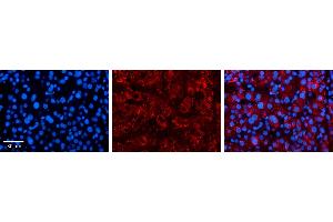 Immunohistochemistry (IHC) image for anti-Solute Carrier Family 25 (Mitochondrial Carrier, Oxoglutarate Carrier), Member 11 (SLC25A11) (C-Term) antibody (ABIN502439) (SLC25A11 抗体  (C-Term))