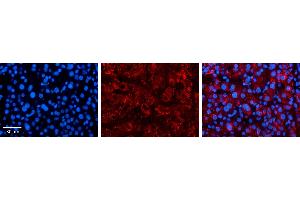 Immunohistochemistry (IHC) image for anti-Solute Carrier Family 25 (Mitochondrial Carrier, Oxoglutarate Carrier), Member 11 (SLC25A11) (C-Term) antibody (ABIN2781592)