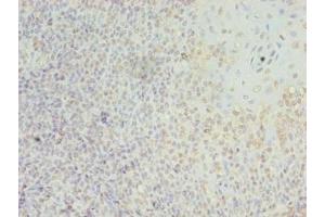 Immunohistochemistry of paraffin-embedded human tonsil tissue using ABIN7158252 at dilution of 1:100 (LILRA2 抗体  (AA 9-275))