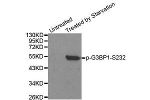 Western blot analysis of extracts from 293 cells, using Phospho-G3BP1-S232 antibody. (G3BP1 抗体  (pSer232))
