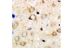 Immunohistochemical analysis of ANR52 staining in mouse brain formalin fixed paraffin embedded tissue section. (ANKRD52 抗体)