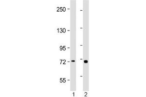 Western blot testing of human 1) placenta and 2) Jurkat lysate with TAP2 antibody at 1:2000. (TAP2 抗体  (AA 100-134))