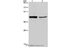 Western blot analysis of Human hepatocellular carcinoma tissue and A549 cell, using GRPR Polyclonal Antibody at dilution of 1:300 (GRPR 抗体)