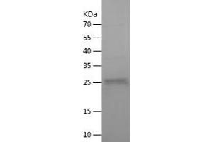 Western Blotting (WB) image for Layilin (LAYN) (AA 23-228) protein (His tag) (ABIN7123725) (Layilin Protein (LAYN) (AA 23-228) (His tag))