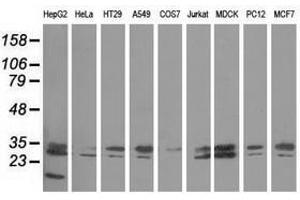 Image no. 2 for anti-Peroxisomal Trans-2-Enoyl-CoA Reductase (PECR) antibody (ABIN1500148) (PECR 抗体)