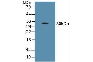 Figure. (FCGR3A 抗体  (AA 26-108))