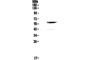 Western blot analysis of Cannabinoid Receptor I using anti-Cannabinoid Receptor I antibody . (CNR1 抗体  (AA 1-75))