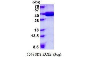 Figure annotation denotes ug of protein loaded and % gel used. (MPST 蛋白)