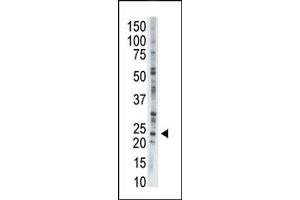 Image no. 1 for anti-Adenylate Kinase 1 (AK1) (C-Term) antibody (ABIN360679)