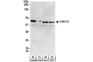 Western Blotting (WB) image for anti-Pre-mRNA Processing Factor 31 (PRPF31) (AA 449-499) antibody (ABIN7454569)