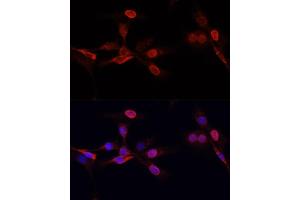 Immunofluorescence analysis of NIH/3T3 cells using TriMethyl-Histone H3-K27 antibody (ABIN7267698) at dilution of 1:25.