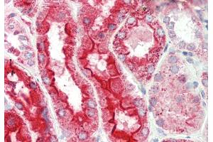 Rabbit Anti-Lrp2bp antibody  Formalin Fixed Paraffin Embedded Tissue: Human Kidney Primary antibody Concentration: 1:100 Secondary Antibody: Donkey anti-Rabbit-Cy3 Secondary Antibody Concentration: 1:200 Magnification: 20x Exposure Time: 0. (LRP2BP 抗体  (Middle Region))
