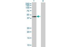 Western Blot analysis of MAGEA3 expression in transfected 293T cell line by MAGEA3 MaxPab polyclonal antibody. (MAGEA3 抗体  (AA 1-314))