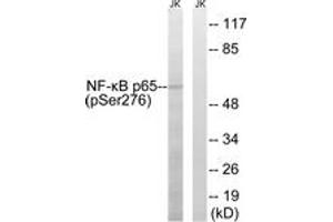 Western blot analysis of extracts from Jurkat cells, using NF-kappaB p65 (Phospho-Ser276) Antibody. (NF-kB p65 抗体  (pSer276))