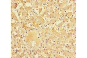 Immunohistochemistry of paraffin-embedded human liver tissue using ABIN7161898 at dilution of 1:100 (NR1I3 抗体  (AA 2-351))