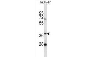 Western Blotting (WB) image for anti-Paroxysmal Nonkinesigenic Dyskinesia (PNKD) antibody (ABIN2996825) (PNKD 抗体)