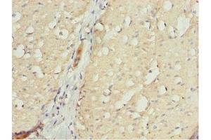 Immunohistochemistry of paraffin-embedded human small intestine tissue using ABIN7161725 at dilution of 1:100 (NLE1 抗体  (AA 206-485))