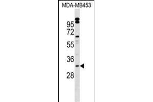 VENTX Antibody (Center) (ABIN1539682 and ABIN2849571) western blot analysis in MDA-M cell line lysates (35 μg/lane). (VENTX 抗体  (AA 58-87))