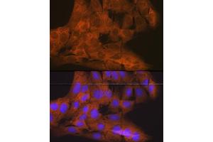 Immunofluorescence analysis of C6 cells using TBK1/NAK Rabbit mAb (ABIN7270723) at dilution of 1:100 (40x lens). (TBK1 抗体)