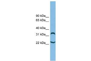 WB Suggested Anti-C6orf134 Antibody Titration: 0. (Chromosome 6 Open Reading Frame 134 (C6orf134) (N-Term) 抗体)