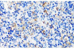 Immunohistochemistry of paraffin-embedded Mouse spleen using TSC2 Polyclonal Antibody at dilution of 1:200 (40x lens). (Tuberin 抗体)