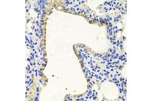Immunohistochemistry of paraffin-embedded mouse lung using PKN1 antibody (ABIN6003498) at dilution of 1/100 (40x lens).