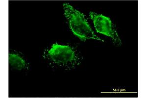 Immunofluorescence of monoclonal antibody to MAPRE3 on HeLa cell. (MAPRE3 抗体  (AA 125-218))