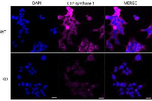Immunocytochemical staining of 293T cells using CTP synthase 1 antibody (ABIN7798174), 1:1,000), Top panel: wild-type (WT), Bottom panal: CTP synthase 1 shRNA knockdown (KD). (Recombinant CTP Synthase 抗体)
