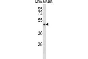 Western Blotting (WB) image for anti-Sirtuin 3 (SIRT3) antibody (ABIN2998084) (SIRT3 抗体)