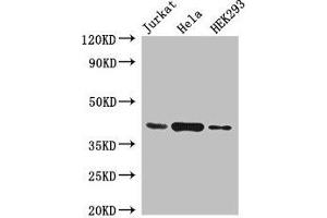 Western Blot Positive WB detected in: Jurkat whole cell lysate, Hela whole cell lysate, HEK293 whole cell lysate All lanes: HLA-C antibody at 4 μg/mL Secondary Goat polyclonal to rabbit IgG at 1/50000 dilution Predicted band size: 41 kDa Observed band size: 41 kDa (HLA-C 抗体  (AA 25-308))