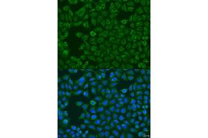 Immunofluorescence analysis of U2OS cells using FMO5 antibody (ABIN2736763) at dilution of 1:100. (FMO5 抗体)