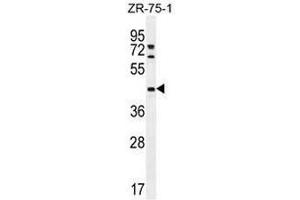 METTL2 Antibody (C-term) western blot analysis in ZR-75-1 cell line lysates (35µg/lane).