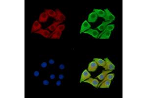 ABIN7097159 and ABIN7101227 staining Hela cells by IF/ICC. (MSTO1 抗体)