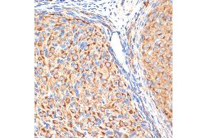 Immunohistochemistry of paraffin-embedded rat ovary using G1 Rabbit mAb (ABIN7265446) at dilution of 1:100 (40x lens). (gamma 1 Adaptin 抗体)