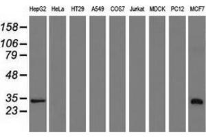 Western Blotting (WB) image for anti-Sulfotransferase Family, Cytosolic, 2A, Dehydroepiandrosterone (DHEA)-Preferring, Member 1 (SULT2A1) antibody (ABIN2732962)