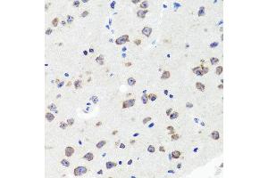 Immunohistochemistry of paraffin-embedded mouse brain using DLG1 antibody at dilution of 1:100 (x40 lens). (DLG1 抗体)