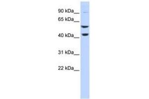 Image no. 1 for anti-ATPase, H+ Transporting, Lysosomal 56/58kDa, V1 Subunit B2 (ATP6V1B2) (C-Term) antibody (ABIN6744046) (ATP6V1B2 抗体  (C-Term))