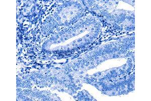 Immunohistochemistry (IHC) image for anti-Cullin 4A (CUL4A) antibody (ABIN1872121) (Cullin 4A 抗体)
