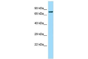 WB Suggested Anti-CAPN8 Antibody Titration: 1. (Calpain 8 抗体  (Middle Region))