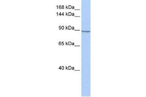 Western Blotting (WB) image for anti-Hexokinase 2 (HK2) antibody (ABIN2459729) (Hexokinase 2 抗体)