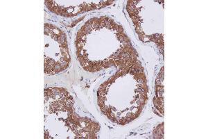 Immunohistochemical analysis of A on paraffin-embedded Human testis tissue. (HDAC6 抗体  (C-Term))