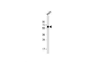 Western Blot at 1:1000 dilution + Hela whole cell lysate Lysates/proteins at 20 ug per lane. (PKM2 抗体  (C-Term))