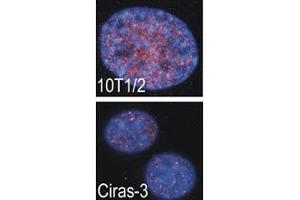 Indirect IF analysis showed that RSKB is localized in the nucleus of parental (10T1/2) and oncogene-transformed (Ciras-3) mouse fibroblasts; DAPI nuclear counterstain. (MSK2 抗体  (AA 322-354))