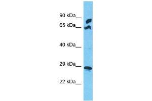 Western Blotting (WB) image for anti-Mitochondrial Ribosomal Protein S5 (MRPS5) (N-Term) antibody (ABIN2791673)