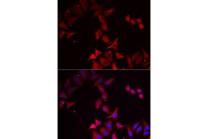 Immunofluorescence analysis of U2OS cell using PCBD1 antibody. (PCBD1 抗体)