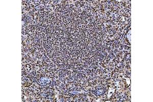 IHC analysis of hnRNP L/HNRNPL using anti-hnRNP L/HNRNPL antibody (ABIN7600130).