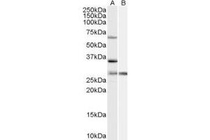 ABIN2564748 (1µg/ml) staining of HeLa cell lysate (35µg protein in RIPA buffer) with (B) and without (A) blocking with the immunising peptide. (PRPF31 抗体  (Internal Region))