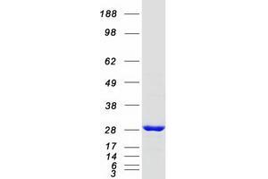 Western Blotting (WB) image for RAB21, Member RAS Oncogene Family (RAB21) protein (Myc-DYKDDDDK Tag) (ABIN2730296)